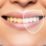 ¿Los cepillos de bambú blanquean los dientes.png