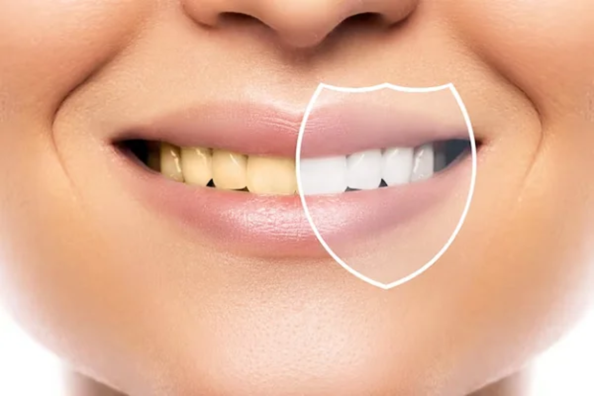 ¿Los cepillos de bambú blanquean los dientes.png
